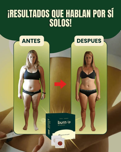 JAPONES BURN UP X 30 PARCHES DE ADELGAZA